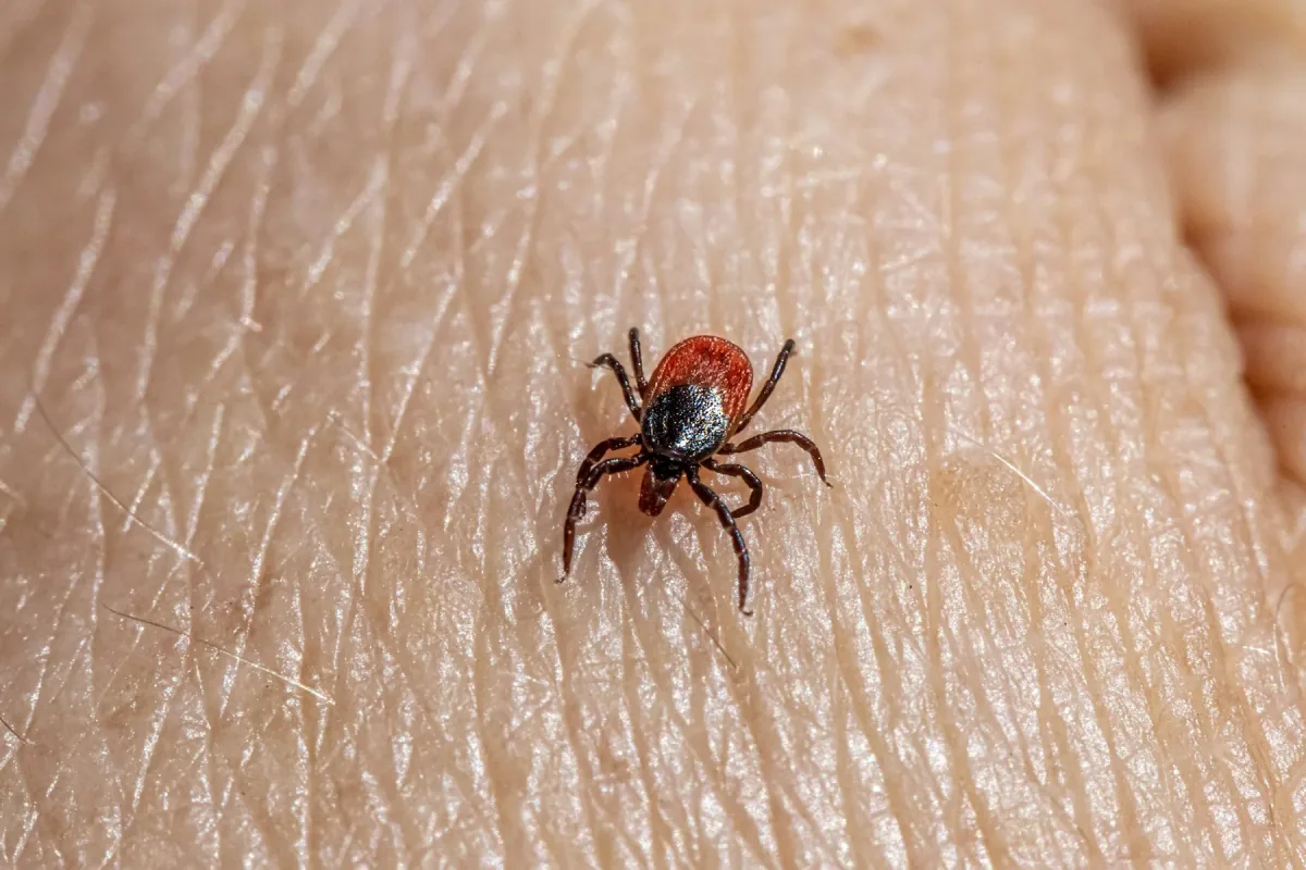 Tick on skin, shown as tick context rather than a flea example